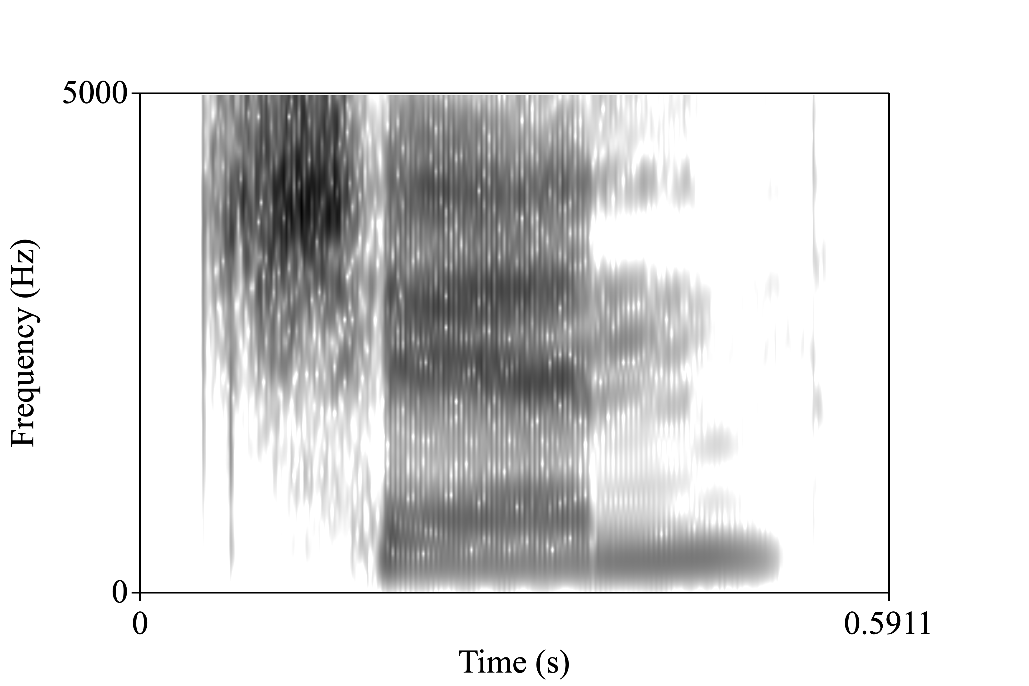 chin spectrogram